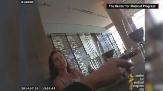 How Much of Your Tax Dollar is Spent Funding Planned Parenthood?  The Center for Medical Progress Sting Videos and the Truth